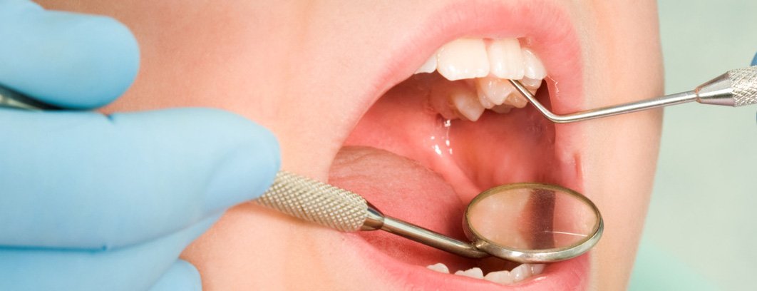 EVENING DENTAL CLINIC THENHIPPALAM